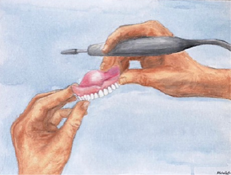 A coloured pencil drawing of someone working on some dentures with a hand drill.